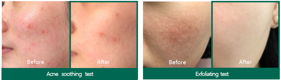 SOME BY MI AHA BHA PHA 30 Days Miracle Acne Clear Foam - 150ml