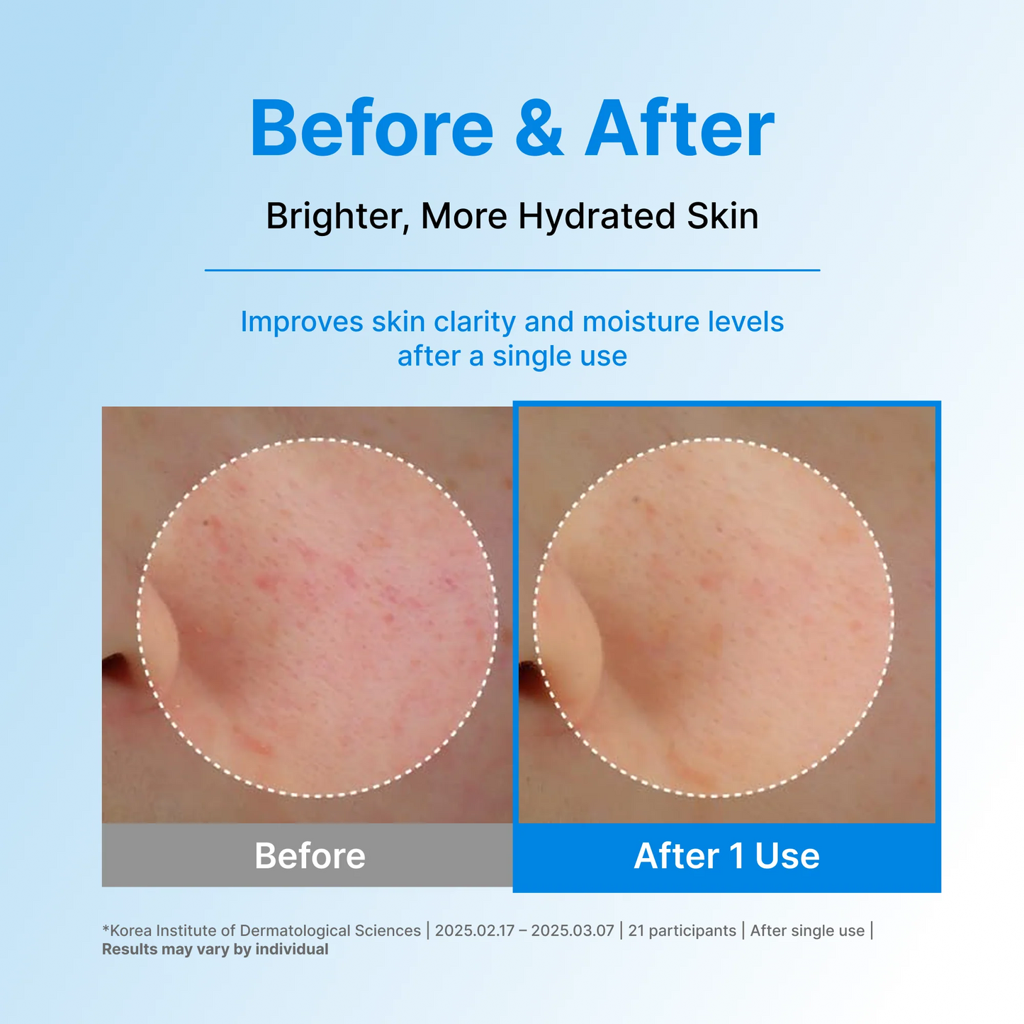 Centellian24 Hyal Waterfull Glow Gel Mask - 1 pc