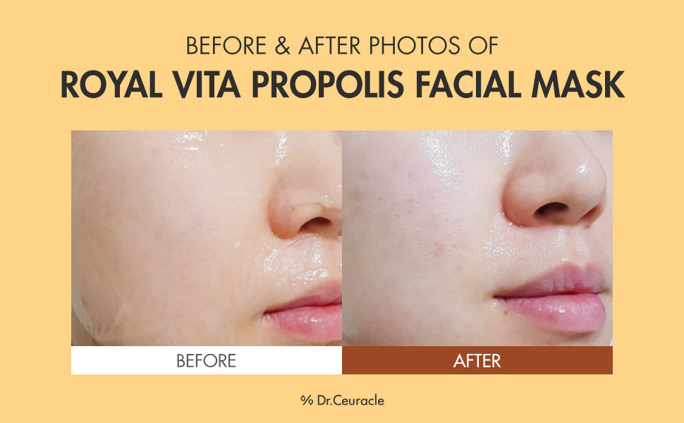 Dr Ceuracle Royal Propolis Anti-Oxidant Mask - 30ml