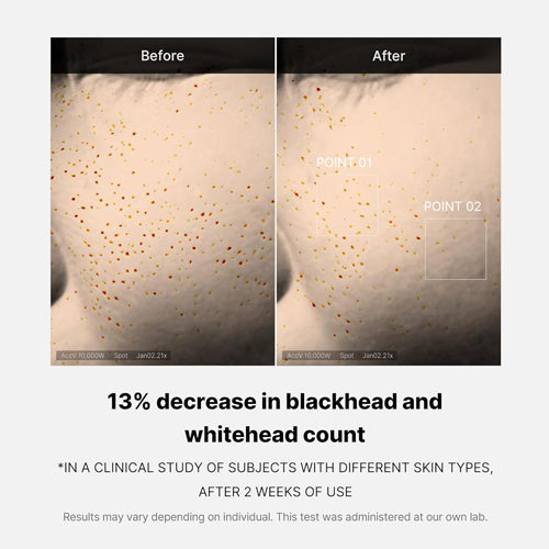 Medicube Zero Pore One Day Serum 30ml