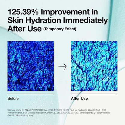 Anua PDRN 100 Hyaluronic Acid Glow Pad 180ml (60 pcs)