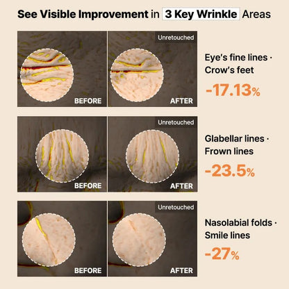 [NEW] COSRX The Alpha-Arbutin Discoloration Care Hydrogel Mask (1 pc)