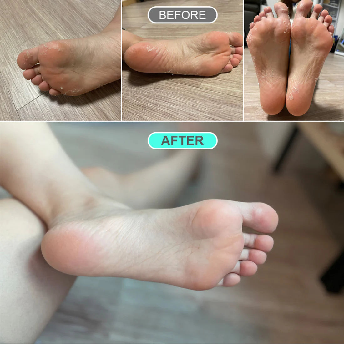 Kocostar Foot Peeling Mask Pack - 1 pair