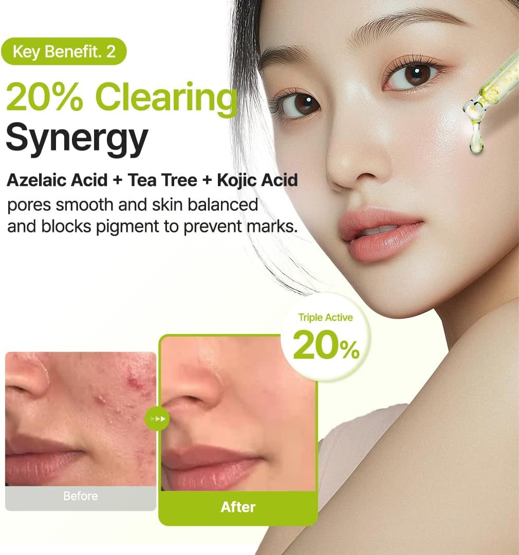 PURITO SEOUL Azelaic Acid 10 Kojic Tea Tree Serum 30ml