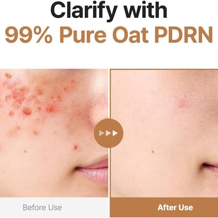 Purito Seoul Oat PDRN Gentle Refining Toner 200ml