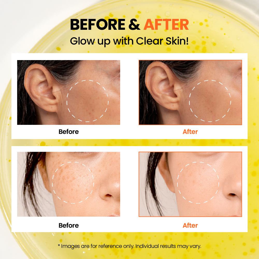 KSECRET Seoul 1988 Glow Serum : Niacinamide 15% + Yuja 30ml