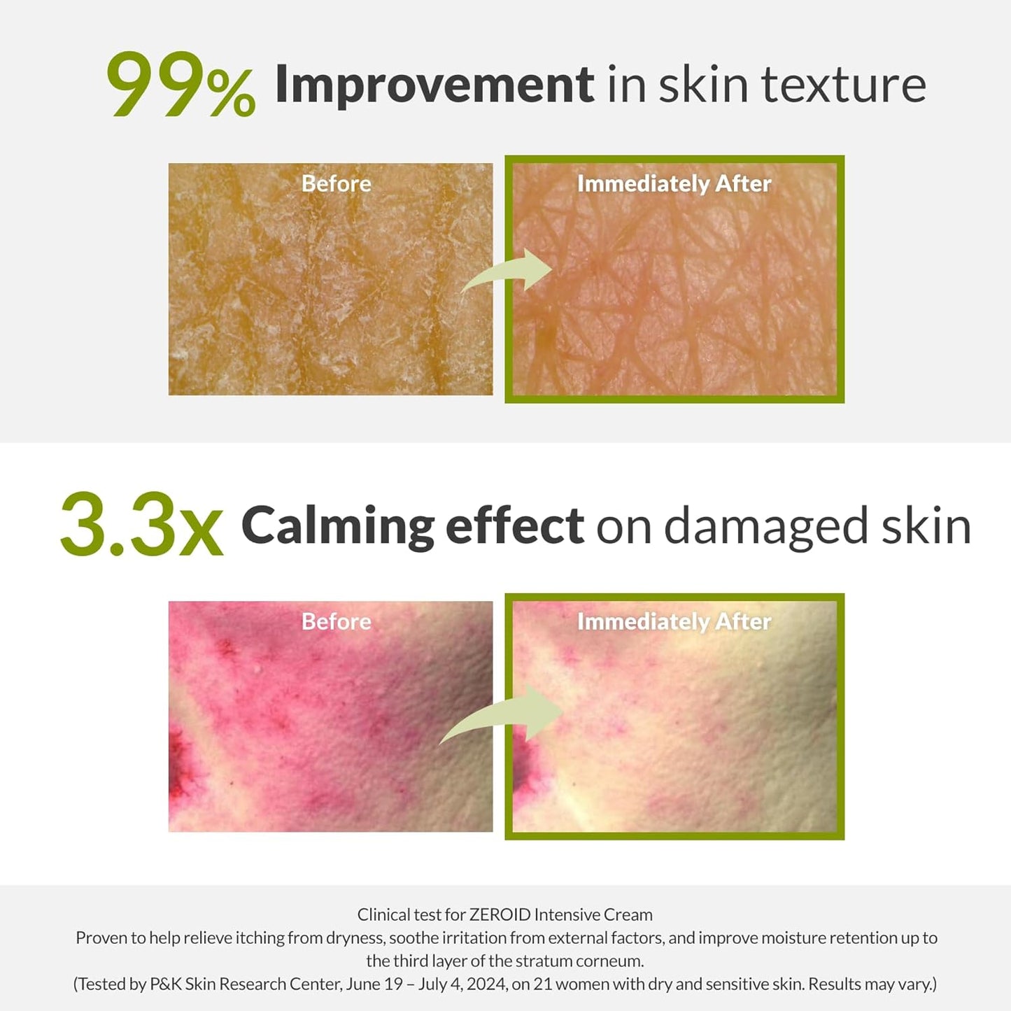 Zeroid Intensive Cream 80ml