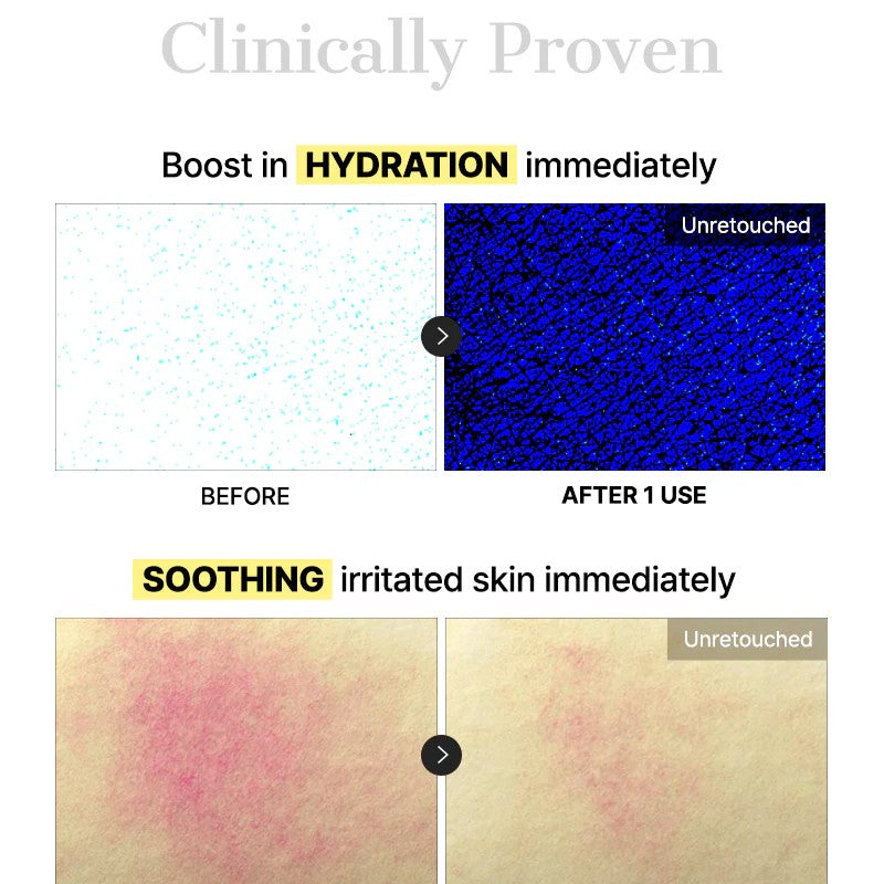 [NEW] Advanced Snail Mucin Glass Glow Hydrogel Mask (1 pc)