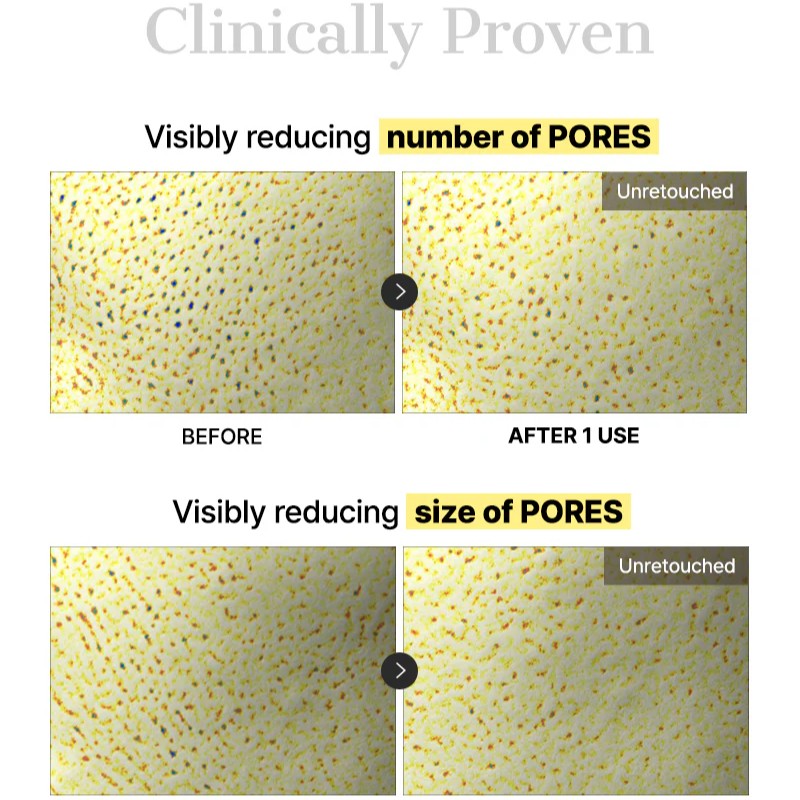 [NEW] Advanced Snail Mucin Glass Glow Hydrogel Mask (1 pc)