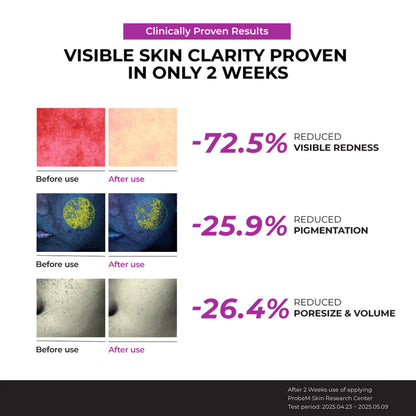 [NEW LAUNCH] Jumiso Niacinamide 10 Serum 40ml