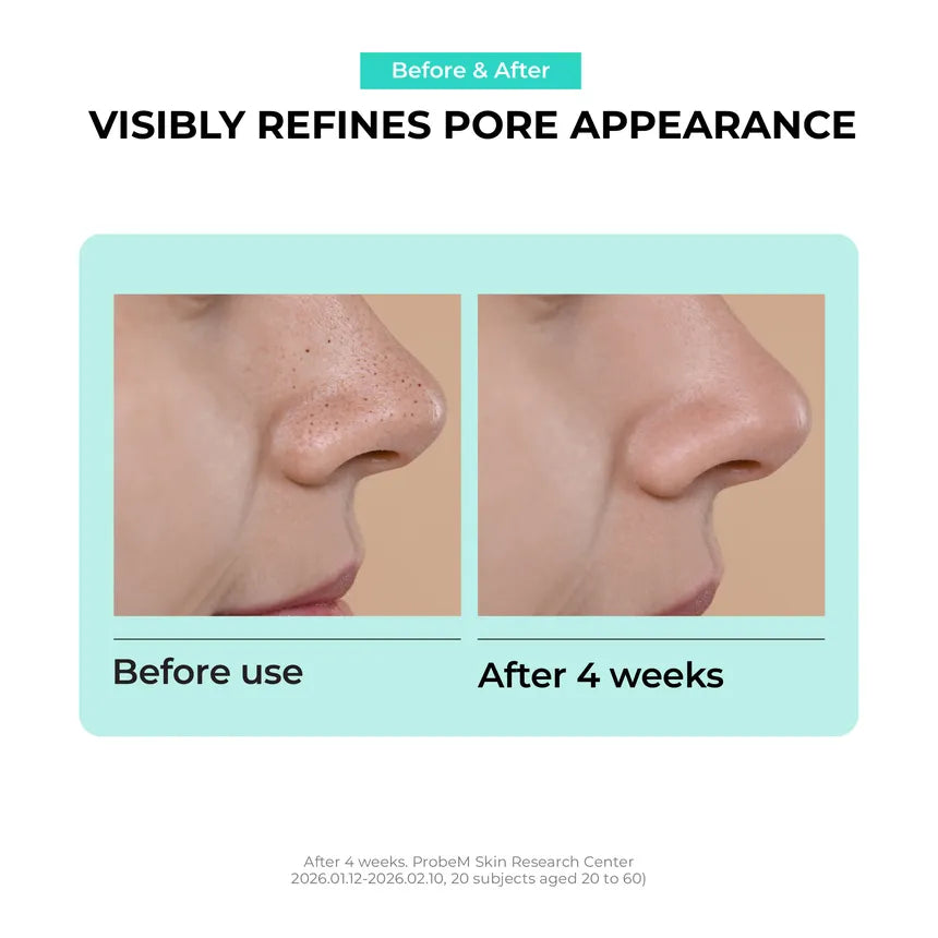 Jumiso Overnight Zero Pore Nose Patch (10 patches)