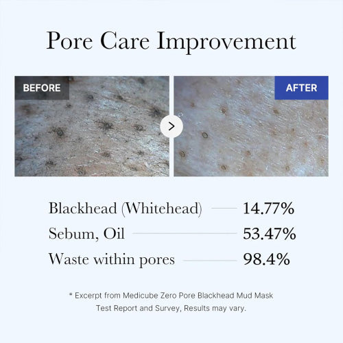 Medicube Zero Pore Blackhead Mud Mask 100ml