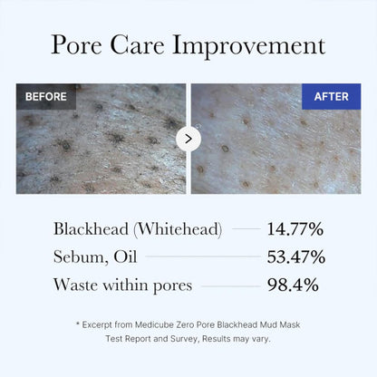 Medicube Zero Pore Blackhead Mud Mask 100ml