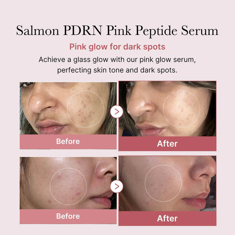 Medicube PDRN Pink Peptide Serum - 30ml
