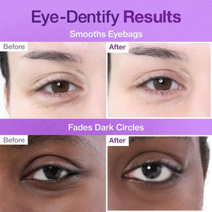 Numbuzin No.9 NAD Collagen Under Eye Patches (1 pair) - Overnight treatment